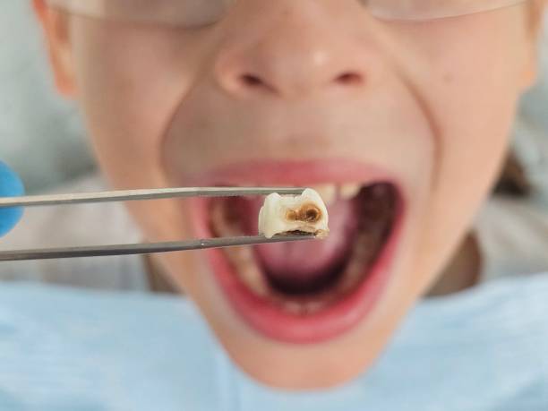 Best Weekend Emergency Dentist in Windsor, VA