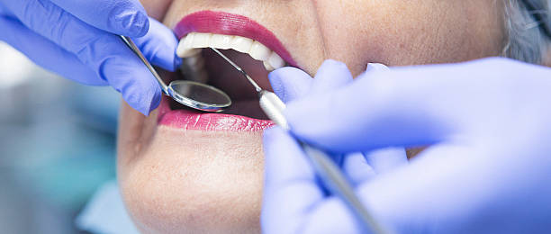 Best Emergency Dentist for Lost Fillings or Crowns in Windsor, VA